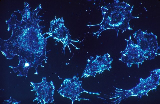 Neue Hanf-Studie – Cannabis lässt Tumor-Zellen platzen!