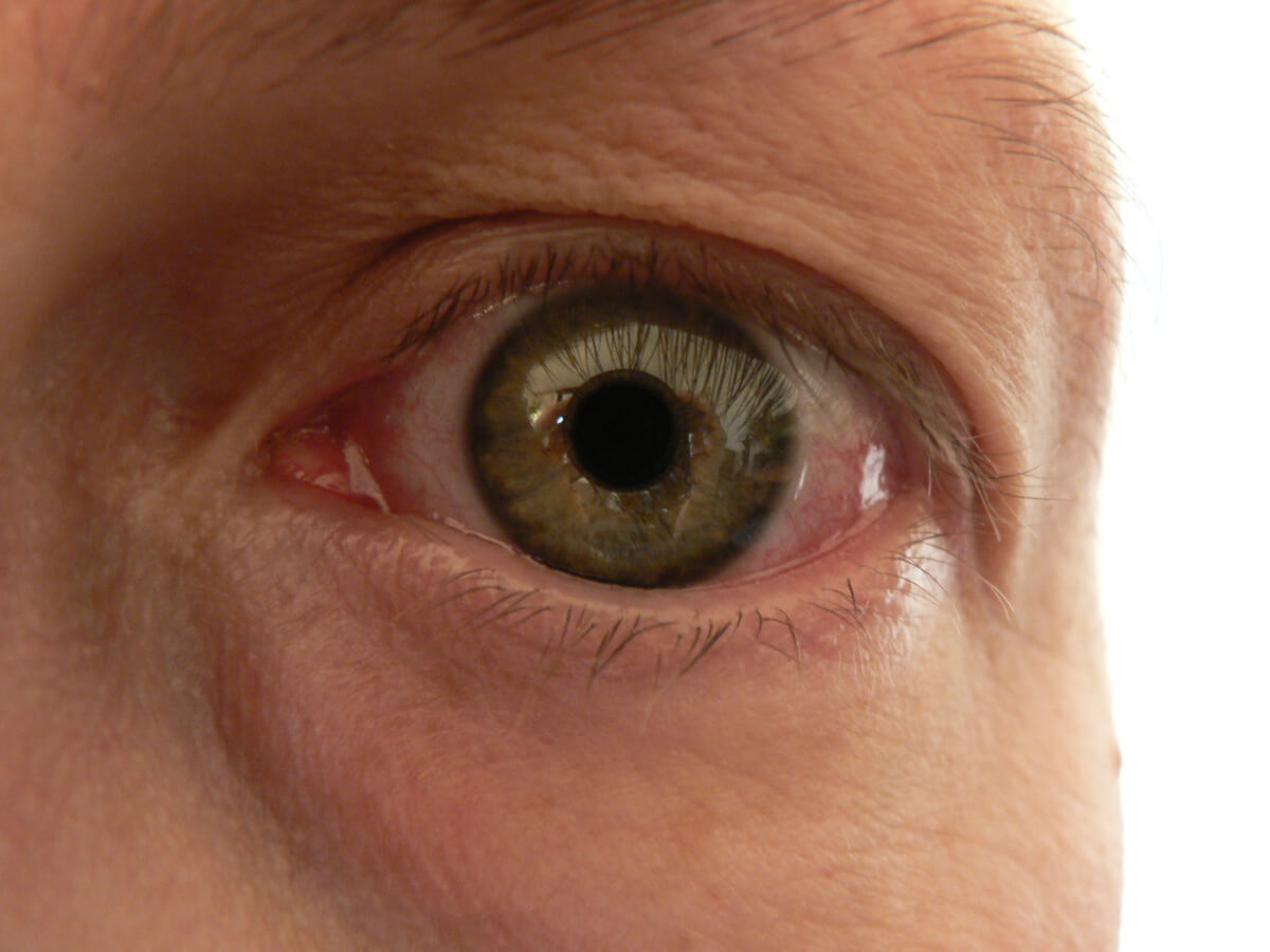 Warum Deine Augen von Cannabis rot werden
